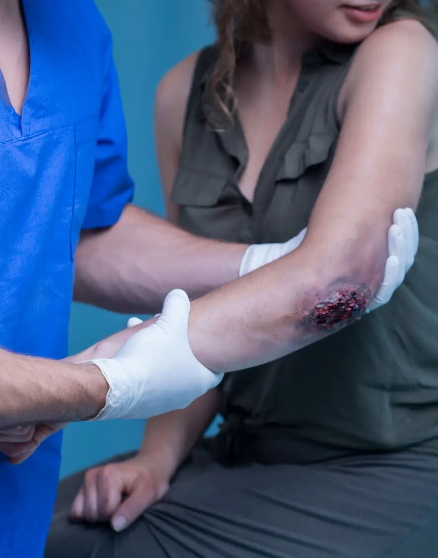 Law Firm for Severe Burns and Scarring
