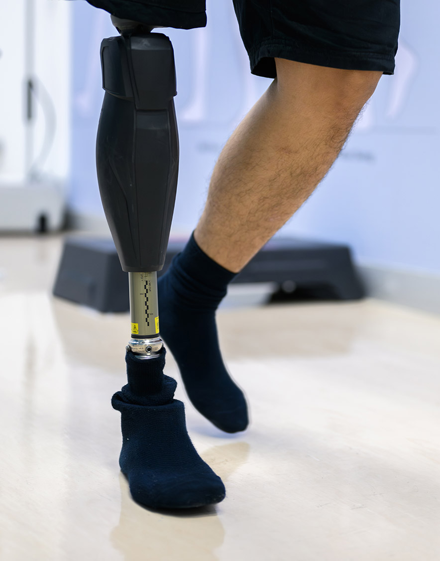 Attorneys for Amputations and Crush Injuries in Dallas